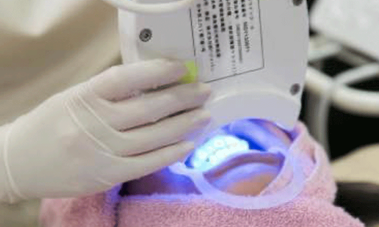 デュアルホワイトニング