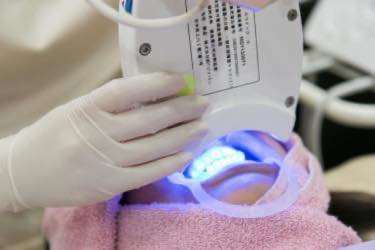 オフィスホワイトニング